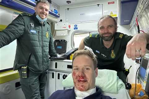 Dan Walker suffers nasty injuries in car crash leaving his face covered in blood – as star says..