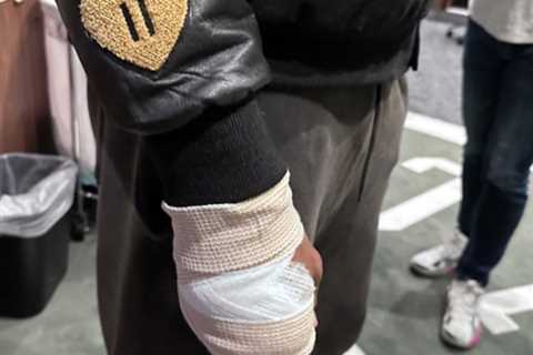 Celtics’ Jaylen Brown receives five stitches after cutting hand on glass
