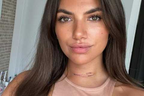 Love Island star Samie Elishi reveals surgery scar amid cancer scare as she waits for results