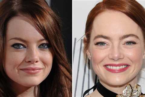 Emma Stone -- Good Genes Or Good Docs?!