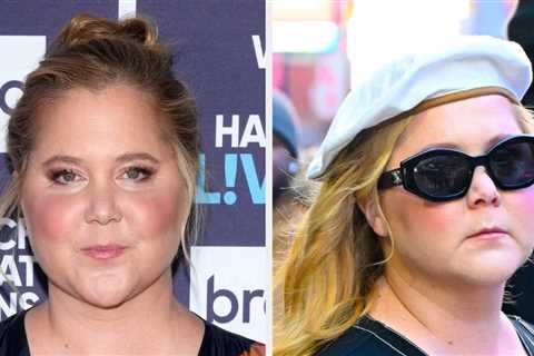 Amy Schumer Revealed Her Cushing Syndrome Diagnosis After Criticism Towards Her Facial Appearance