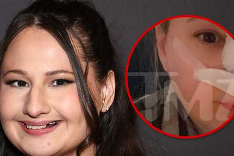Gypsy Rose Blanchard Recovering in First Look After Nose Job