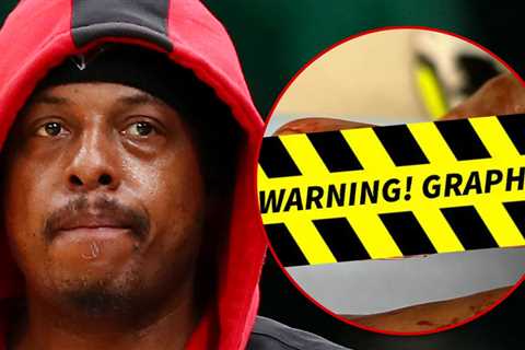 Paul Pierce Hospitalized After Suffering Gruesome Finger Injury