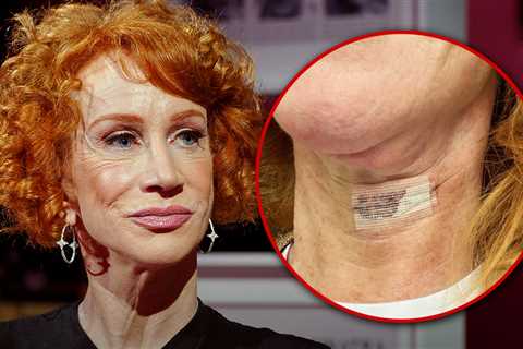 Kathy Griffin Shares IG Pic After Second Vocal Cord Surgery