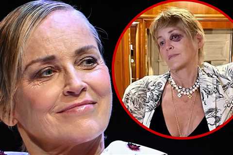 Sharon Stone Shows Off Black Eye During Turkey Vacation