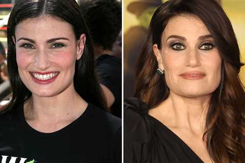 Idina Menzel -- Good Genes or Good Docs?!