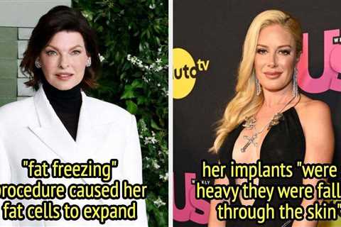 14 Celebs Who've Been Extremely Candid About The Negative Side Effects Of Their Cosmetic Procedures