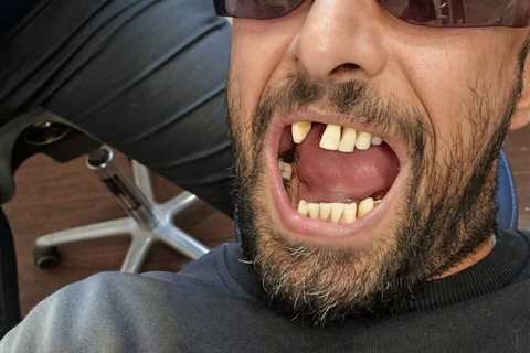 Coronation Street star finally repays debt to friend after dental drama