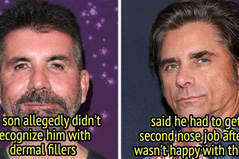 7 Famous Men Who Regretted Cosmetic Surgery