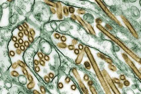 Bird Flu: Symptoms and Treatment During H5N1 Outbreak in California