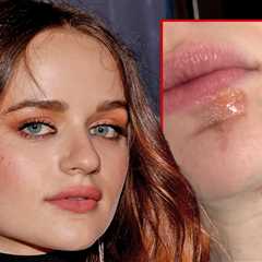 Joey King Ends Up With Facial Burns While Cooking Shallots in Hot Oil