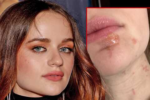 Joey King Ends Up With Facial Burns While Cooking Shallots in Hot Oil