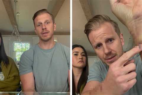 'Bachelor' Sean Lowe Attacked 3 Times by Rescue Dog, 'Blood Everywhere'