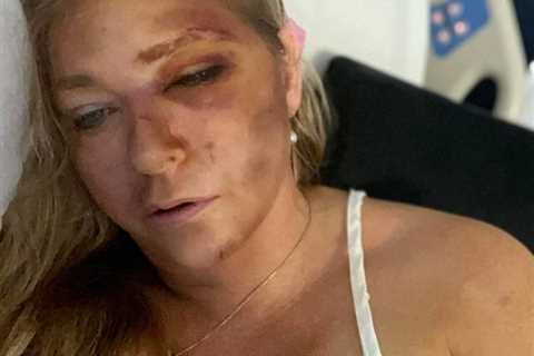 Prince Andrew Accuser Quietly Slips Out Hospital Back Door After Dramatic Dying Claims