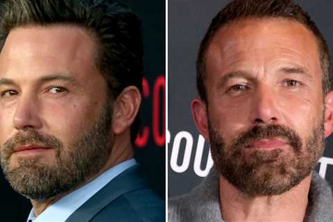 Ben Affleck -- Good Genes or Good Docs?!