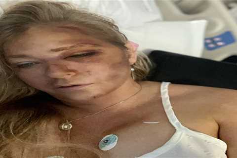 Virginia Giuffre Speaks Out After Bus Crash Leaves Her Hospitalised