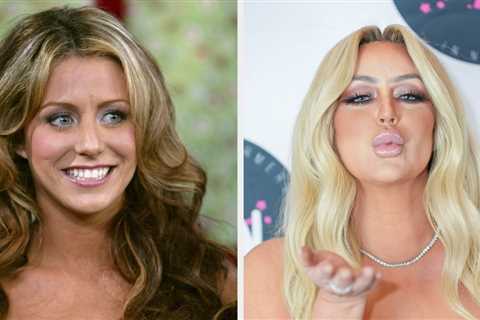 Aubrey O'Day Removed Her Lip Fillers, And What A Difference