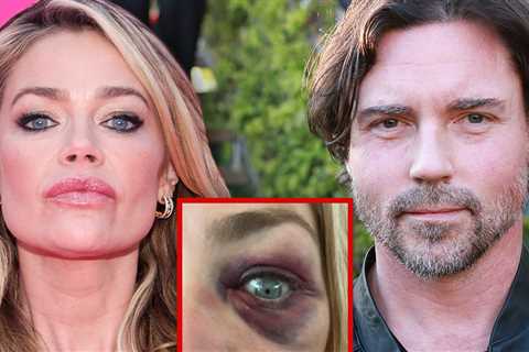 Denise Richards' Estranged Husband Denies Abuse Allegations