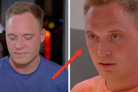 Jimmy From Love Is Blind Shared How Much His Hair Transplant Cost, And My Goodness