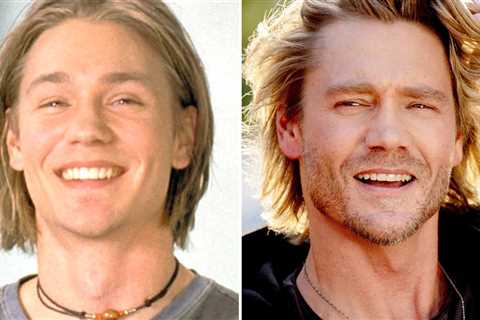 Chad Michael Murray -- Good Genes or Good Docs?!