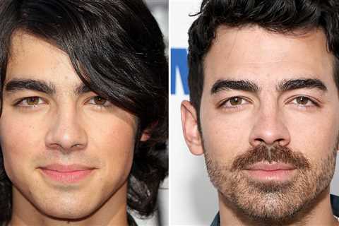Joe Jonas Good Genes or Good Docs?!