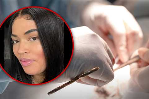 NYPD Detective Dies in Colombia Week After Butt Lift