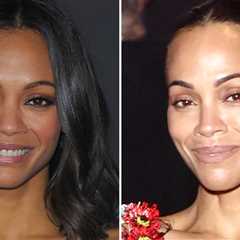 'Avatar' Queen Zoe Saldana Good Genes or Good Docs?!