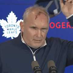 Maple Leafs’ Craig Berube shows off terrifying cut after gym accident