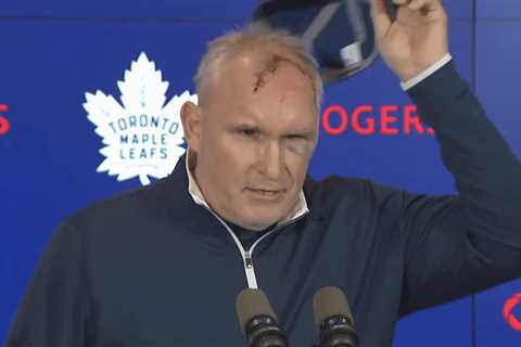 Maple Leafs’ Craig Berube shows off terrifying cut after gym accident