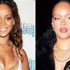 Rihanna Good Genes or Good Docs?!