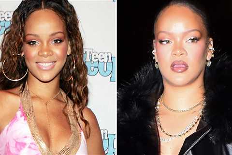 Rihanna Good Genes or Good Docs?!