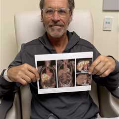 Ron Duguay details great lengths he’s going to in cancer fight — and its impact on Sarah Palin..