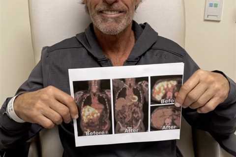 Ron Duguay details great lengths he’s going to in cancer fight — and its impact on Sarah Palin..