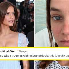 “It’s No Joke”: People With Endometriosis Are Extra Emotional About Barbara Palvin’s Pregnancy News ..
