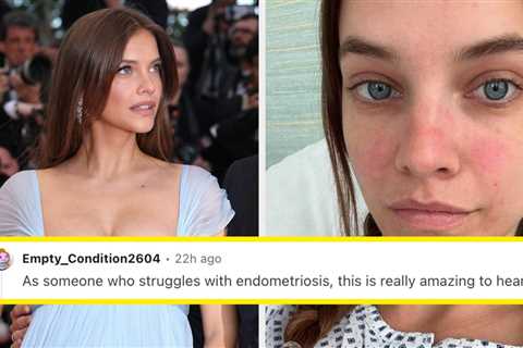 “It’s No Joke”: People With Endometriosis Are Extra Emotional About Barbara Palvin’s Pregnancy News ..